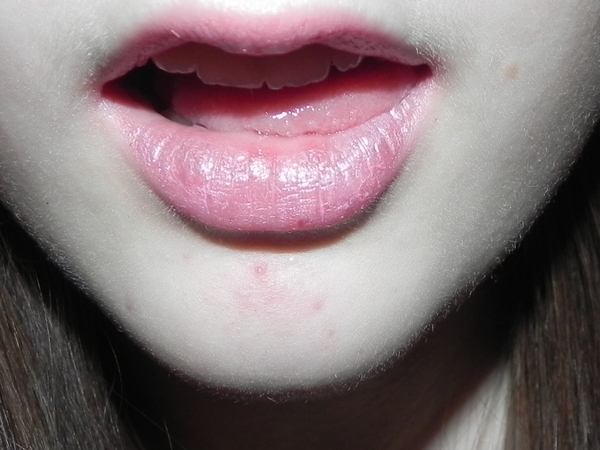 Lehleas